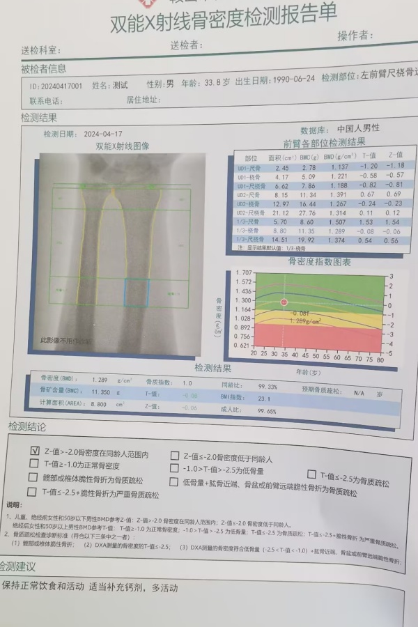雙能X射線骨密度儀：準(zhǔn)確測(cè)量骨密度，助力骨質(zhì)疏松防治，守護(hù)骨骼健康